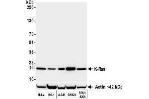 Western Blotting (WB) image for anti-HRas proto-oncogene, GTPase (HRAS) (AA 50-100) antibody (ABIN7795737)