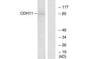 Western Blotting (WB) image for anti-Cadherin 11 (CDH11) (Internal Region) antibody (ABIN1850215) (OB Cadherin antibody  (Internal Region))