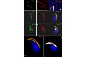 Localization of mTAS1R3 (green) and CD46 (red) in mouse sperm revealed by Confocal Microscopy and Structure Illumination Microscopy (SIM). (CD46 antibody)