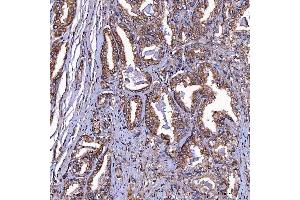IHC analysis of TOMM34 using anti-TOMM34 antibody (ABIN7599253). (TOMM34 antibody  (AA 1-309))