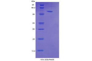 SDS-PAGE (SDS) image for Trefoil Factor 3 (Intestinal) (TFF3) (AA 23-81) protein (His tag,MBP tag) (ABIN2123798)