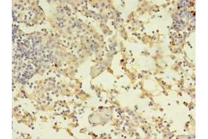 Immunohistochemistry of paraffin-embedded human thymus tissue using ABIN7150034 at dilution of 1:100 (A Disintegrin and Metallopeptidase Domain 1a (ADAM1A) (AA 214-504) antibody)