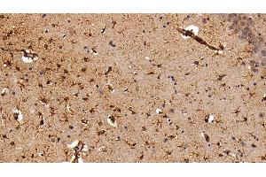 Detection of GFAP in Rat Cerebrum Tissue using Polyclonal Antibody to Glial Fibrillary Acidic Protein (GFAP) (GFAP antibody  (AA 1-430))