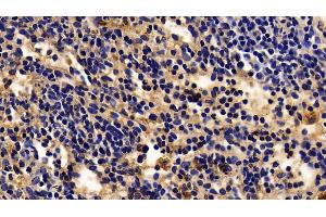 Detection of ACP5 in Rabbit Spleen Tissue using Polyclonal Antibody to Acid Phosphatase 5, Tartrate Resistant (ACP5) (ACP5 antibody  (AA 74-321))