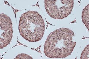Immunohistochemistry of paraffin-embedded rat testis using RanG Rabbit mAb (ABIN7269846) at dilution of 1:100 (40x lens). (RANGAP1 antibody)
