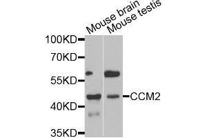 Western blot analysis of extracts of mouse brain and mouse testis tissues, using CCM2 antibody. (CCM2 antibody)