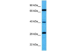 Host:  Mouse  Target Name:  DMTF1  Sample Tissue:  Mouse Kidney  Antibody Dilution:  1ug/ml (DMP1 antibody  (Middle Region))