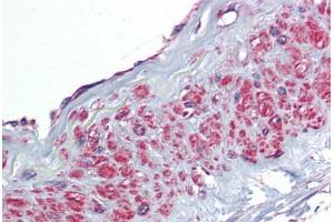 anti-Transforming Growth Factor, beta-Induced, 68kDa (TGFBI) (AA 601-650) antibody