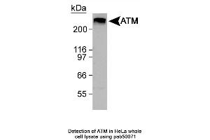 Image no. 1 for anti-Ataxia Telangiectasia Mutated (ATM) (C-Term) antibody (ABIN363380) (ATM antibody  (C-Term))
