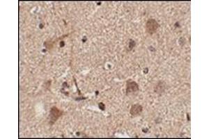 Immunohistochemistry of Slitrk5 in human brain tissue with this product at 2. (SLITRK5 antibody  (Center))