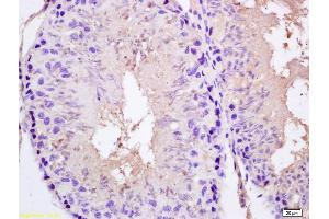 Formalin-fixed and paraffin embedded rat testis labeled with Rabbit Anti SPAG5/MAP126/Astrin Polyclonal Antibody, Unconjugated (ABIN672261) at 1:200 followed by conjugation to the secondary antibody and DAB staining