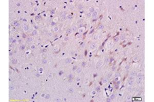 Formalin-fixed and paraffin embedded rat brain labeled with Anti-ErbB-3/HER3 Polyclonal Antibody, Unconjugated (ABIN686767) at 1:200 followed by conjugation to the secondary antibody and DAB staining. (ERBB3 antibody  (AA 661-760))