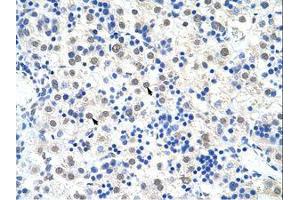 Image no. 1 for anti-DEAD (Asp-Glu-Ala-Asp) Box Polypeptide 47 (DDX47) (C-Term) antibody (ABIN203146) (DDX47 antibody  (C-Term))