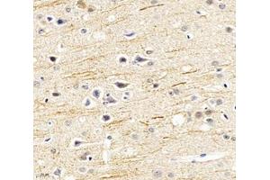 Immunohistochemistry analysis of paraffin-embedded mouse hippocampus using SCN8A (ABIN7075647) at dilution of 1: 1200 (SCN8A antibody)