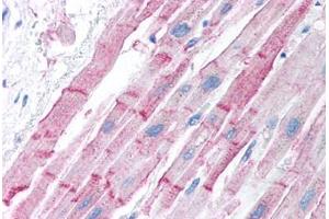 Human Heart (formalin-fixed, paraffin-embedded) stained with ESR2 antibody ABIN214750 at 5 ug/ml followed by biotinylated goat anti-rabbit IgG secondary antibody ABIN481713, alkaline phosphatase-streptavidin and chromogen. (ESR2 antibody  (AA 82-131))