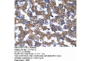 Rabbit Anti-VDAC1 Antibody  Paraffin Embedded Tissue: Human Liver Cellular Data: Hepatocytes Antibody Concentration: 4. (VDAC1 antibody  (C-Term))