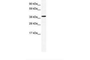 Image no. 1 for anti-Annexin A7 (ANXA7) (AA 128-177) antibody (ABIN202593) (Annexin VII antibody  (AA 128-177))