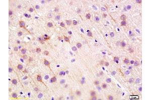 Formalin-fixed and paraffin embedded mouse brain labeled with Anti Caspr2 Polyclonal Antibody, Unconjugated (ABIN1386423) at 1:200 followed by conjugation to the secondary antibody and DAB staining (CNTNAP2 antibody  (AA 801-900))