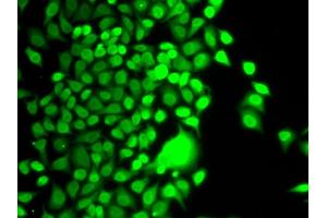 Immunofluorescence analysis of U2OS cells using HAT1 antibody.
