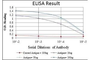 Red: Control Antigen (100 ng), Purple: Antigen (10 ng), Green: Antigen (50 ng), Blue: Antigen (100 ng), (MAP3K2 antibody)