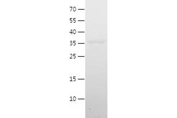 RNASEH2C Protein (AA 38-164) (His-IF2DI Tag)