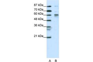 Western Blotting (WB) image for anti-General Transcription Factor IIF, Polypeptide 1, 74kDa (GTF2F1) antibody (ABIN2463819) (GTF2F1 antibody)