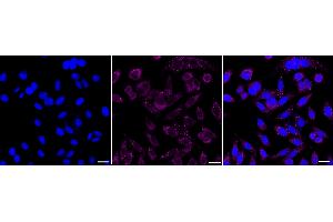 Immunocytochemical staining of HepG2 cells with Melanocortin 5 receptor antibody (ABIN7799355), 1:1,000).