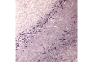 IHC on rat brain using Rabbit antibody to Vesicle-trafficking protein SEC22b (SEC22B, SEC22L1,  ERS24): IgG (ABIN351370) at a concentration of 30 µg/ml. (SEC22B antibody  (AA 2-50))