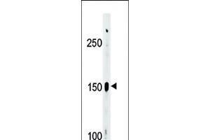 Western blot analysis of Phospho-ABL1/ABL2(439)Antibody Pab (ABIN389506 and ABIN2839561) in  cell line lysate (35 μg/lane). (ABL2 antibody  (pTyr393, pTyr439))