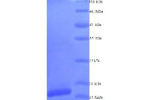 SDS-PAGE (SDS) image for SIVA1, Apoptosis-Inducing Factor (SIVA1) (AA 1-110), (Isoform 2) protein (His tag) (ABIN5713834) (SIVA1 Protein (AA 1-110, Isoform 2) (His tag))