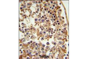 FANCC Antibody IHC analysis in formalin fixed and paraffin embedded testis tissue followed by peroxidase conjugation of the secondary antibody and DAB staining.