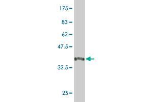 Western Blot detection against Immunogen (44 KDa) . (MYL2 antibody  (AA 1-166))