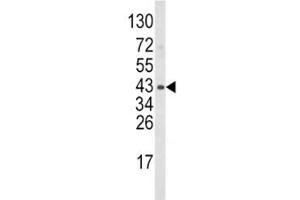 Western blot analysis of WNT5B antibody and mouse bladder tissue lysate. (WNT5B antibody  (AA 153-182))