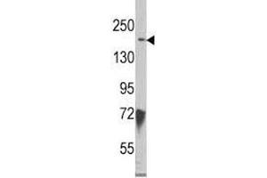 Western blot analysis of JMJD3 antibody and HeLa lysate (Kdm6b antibody  (AA 1-30))