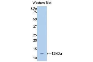 Detection of Recombinant MIP5, Human using Polyclonal Antibody to Macrophage Inflammatory Protein 5 (MIP5) (CCL15 antibody  (AA 22-113))