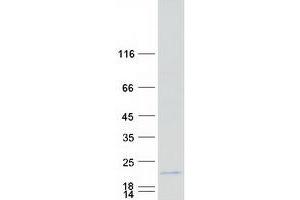 EF-Hand Calcium Binding Domain 11 (EFCAB11) protein (Myc-DYKDDDDK Tag)