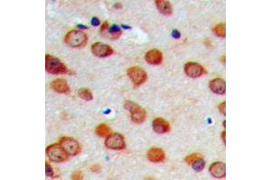 Immunohistochemical analysis of Cytochrome P450 26C1 staining in human brain formalin fixed paraffin embedded tissue section. (CYP26C1 antibody  (N-Term))