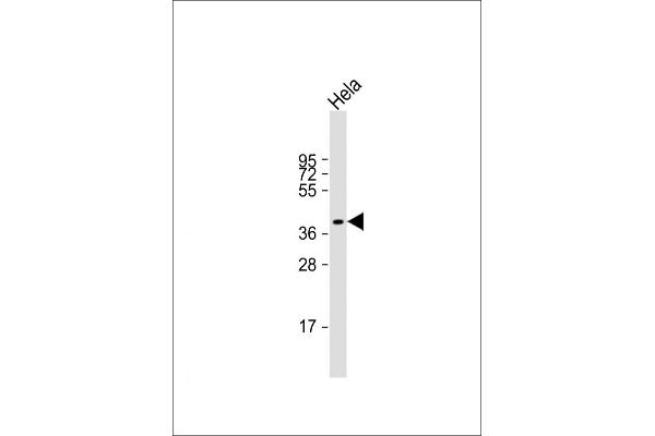 LPGAT1 antibody  (AA 144-177)