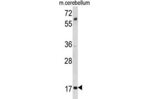 Western Blotting (WB) image for anti-Myelin Associated Oligodendrocyte Basic Protein (MOBP) antibody (ABIN3002875) (MOBP antibody)