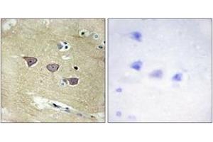 Immunohistochemistry analysis of paraffin-embedded human brain tissue, using CAMK5 Antibody. (CAMKV antibody  (AA 211-260))