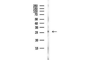 anti-TGFB-Induced Factor Homeobox 2 (TGIF2) antibody