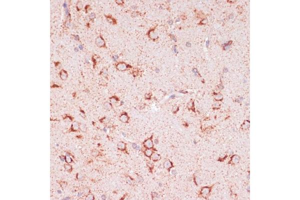 ENTPD6 antibody  (AA 61-300)