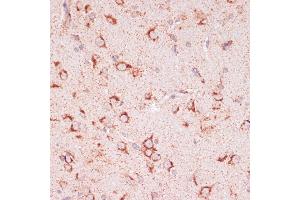 Immunohistochemistry of paraffin-embedded rat brain using ENTPD6 antibody (ABIN7266897) at dilution of 1:100 (40x lens). (ENTPD6 antibody  (AA 61-300))