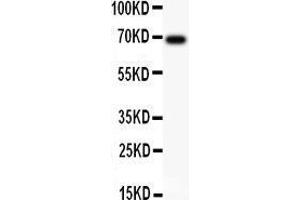 Anti-AFP Picoband antibody,  All lanes: Anti AFP  at 0. (alpha Fetoprotein antibody  (AA 378-609))