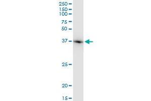 ACTB monoclonal antibody (M03), clone 1E7. (beta Actin antibody  (AA 1-375))