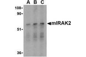 Western blot analysis of IRAK2 in RAW264. (IRAK2 antibody  (C-Term))