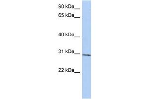 WB Suggested Anti-C14orf172 Antibody Titration:  0. (TRMT61A antibody  (N-Term))