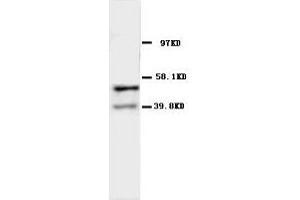 Image no. 2 for anti-Acetylcholine Receptor Subunit alpha (CHRNA1) (N-Term) antibody (ABIN1495052) (CHRNA1 antibody  (N-Term))