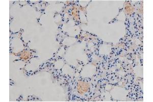 ABIN6267230 at 1/200 staining Mouse lung tissue sections by IHC-P. (IKK-alpha /IKK-beta antibody  (pSer180, pSer181))