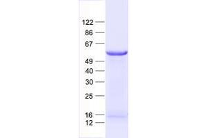 Validation with Western Blot (ZNF79 Protein (His tag))